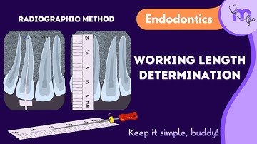 Working Length Determination | Radiographic Method | Endodontics | Animated explanation
