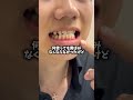 1ヶ月前の俺ガチで黄ばみやばかった⚠️でもこの歯磨き粉使えば清潔感えぐいよ#黄ばみ #清潔感 #口臭 #メンズ美容 #男磨き pr