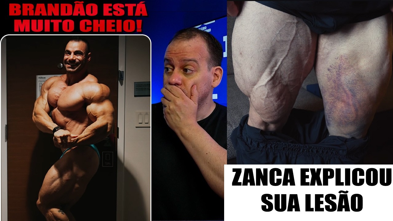 Zancanelli conta os detalhes de sua lesão - Qual será o próximo show? + Rafael Brandão muto cheio