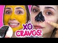 COMO ACABAR COM CRAVOS E ESPINHAS + RECEITAS CASEIRAS | #JanaTodoDia25