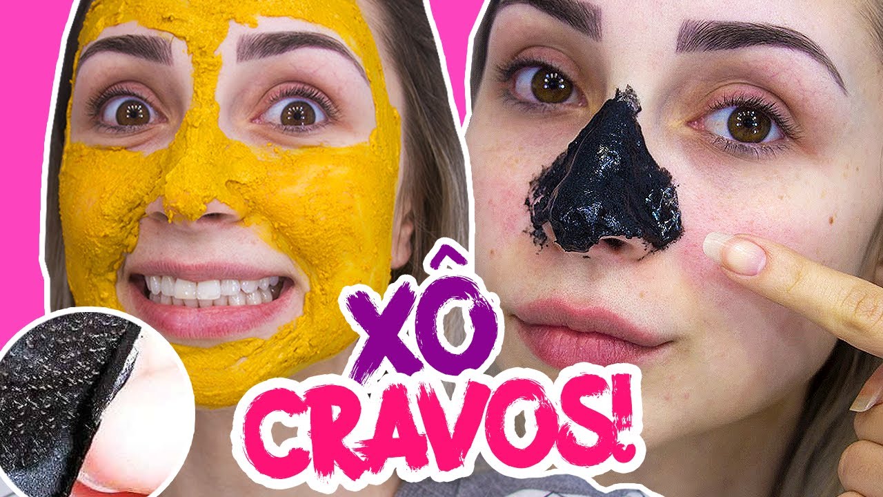 COMO ACABAR COM CRAVOS E ESPINHAS + RECEITAS CASEIRAS | #JanaTodoDia25