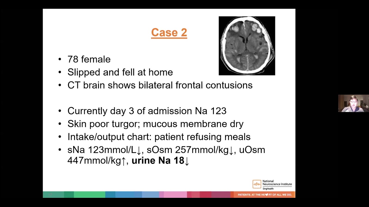 Sodium Management in the Neurosurgery Patient YouTube