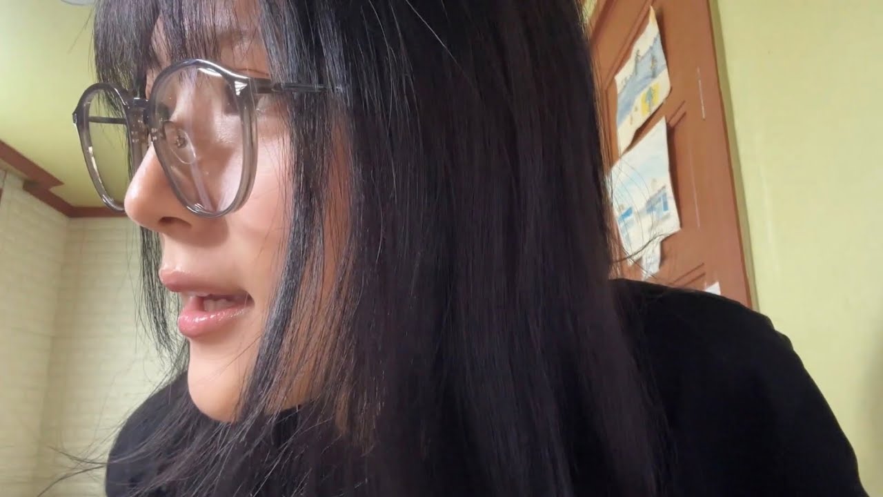 초딩때 코에 돌맞고 수술한 썰 브이로그