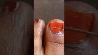 Easy Toe Nail Art Design For Beginners 🍓 Simple and Classy Nails 💅 #shorts #nails