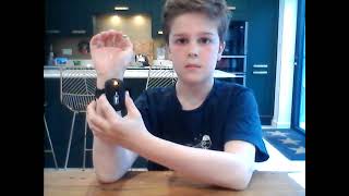 Clinical trial shows wrist device significantly reduces tics in Tourette syndrome