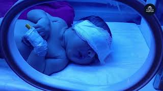 This Tiny Newborn Is Getting Life-Saving Care Under Blue Lights ✨ | Phototherapy Journey