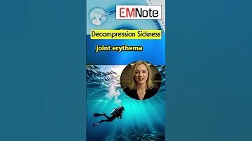 Decompression Sickness Type I 