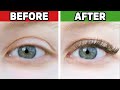 #1 Best Remedy Restore Eyelashes