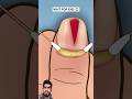ASMR animation Finger piercing removal treatment #asmr #animation #shortsvideo #trending
