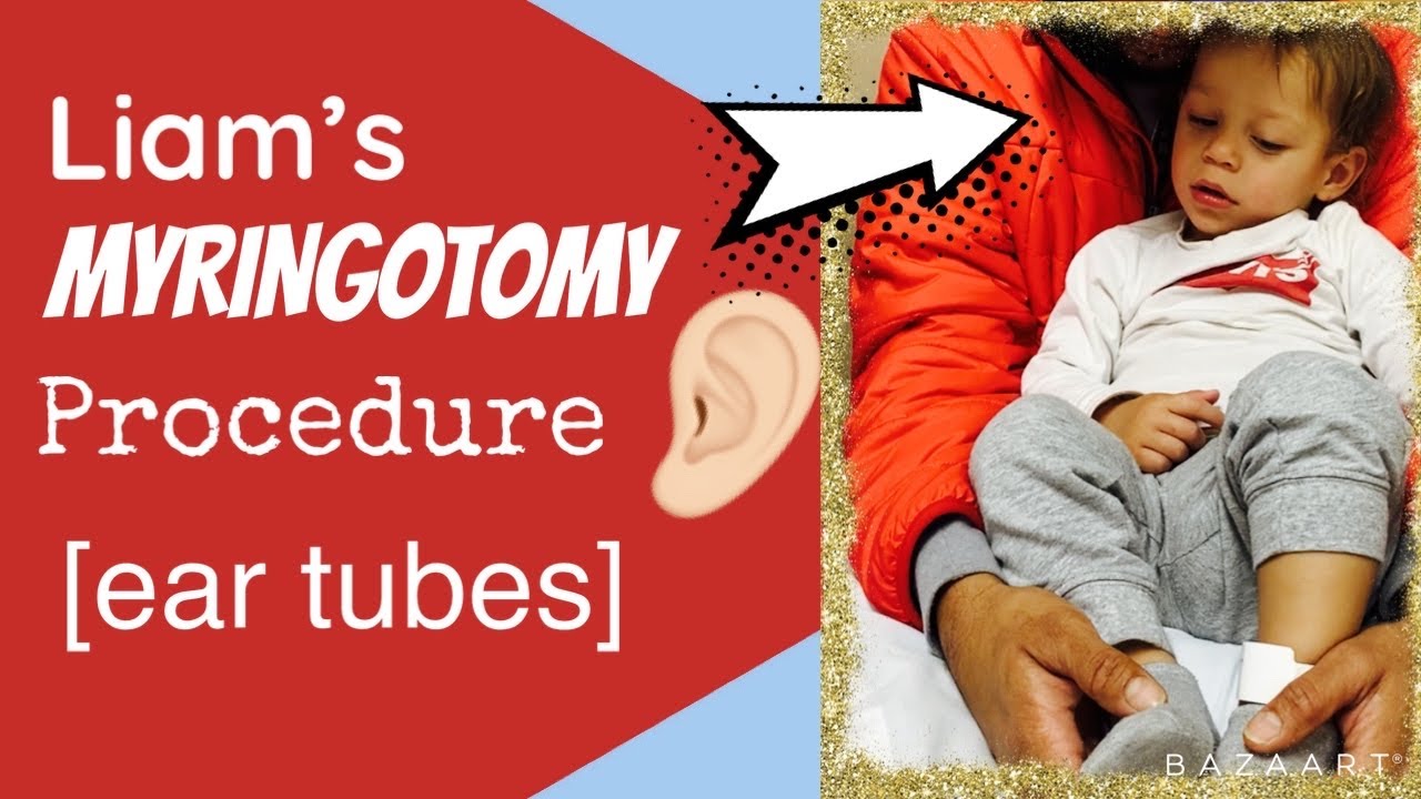 Liam’s Ear Tube Surgery & Recovery YouTube
