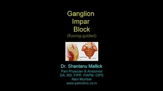 Ganglion Impar Block