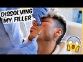 I GOT MY FILLER DISSOLVED…😱 | Danny Defreitas