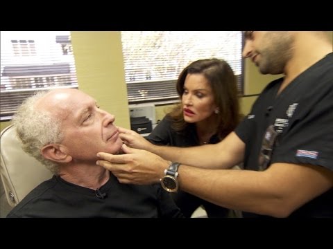 Janice Dickinson'S Fiance Gets 7-Hour Plastic Surgery For Wedding - Youtube