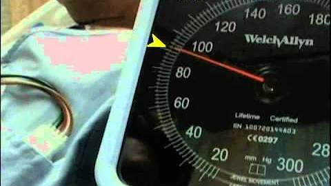 How to Measure Pulsus Paradoxus - (Real Patient!) - Stanford Medicine 25