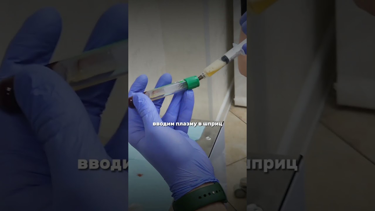 Как проходит процедура плазмолифтинг десен #стоматологияспб