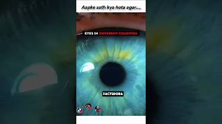 Eye Diseases Explained