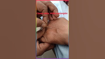 how to use scalp vein set #trendingshorts