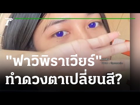 ผู้ป่วยโควิดตาเปลี่ยนสี หลังกินยาฟาวิพิราเวียร์ | 06-01-65 | ข่าวเย็นไทยรัฐ