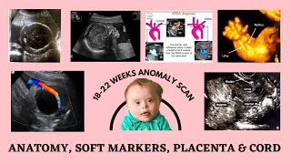 Anatomy, Soft Markers, Placenta & Cord | DrOzaConnects | Dr Nisheeth Oza screenshot 4