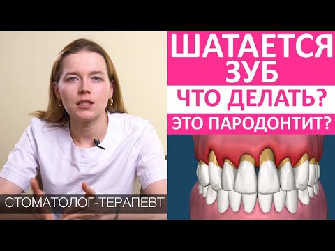 Видео: 3 способа позаботиться о расшатывании зубов