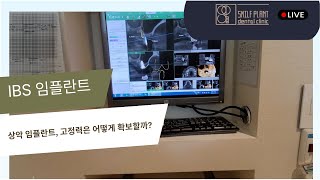 상악어금니, IBS임플란트로 끝낼 수 있는 수술 뒤 이야기 1편