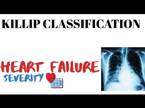 Killip Classification | Heart failure | cardiovascular system ...