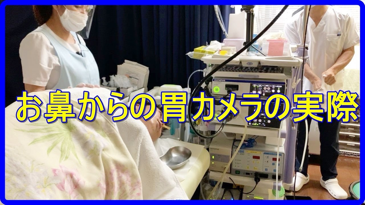 胃 カメラ 鼻
