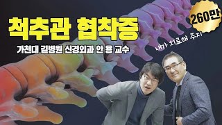 척추관협착증, 안용 교수에게 묻다
