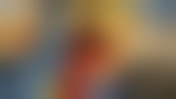 CRB curvilinear modification to Retromandibular approach for managementof subcondylar fractures