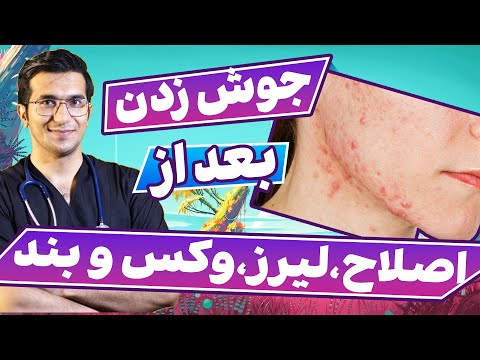 تصویری: چگونه از جوش های گردن بعد از اصلاح جلوگیری کنیم؟