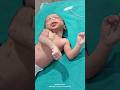 New born baby &amp; seizure #shick baby #Not cry afterbirth