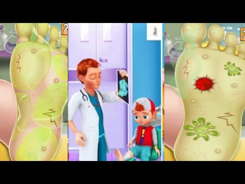 Foot Surgery Doctor Care Gameplay Walkthrough Level 02 - Android,Ios(Part 2)