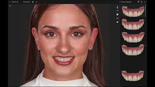Smilecloud Tutorial 3Dna Ai Smile Design And Cloud Dentistry Digital Dentistry Mastercl 2160P,
