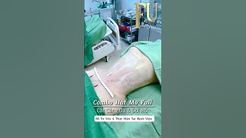 Hút Mỡ Bụng Siết Cơ Cắt Da Thừa Dời Rốn Cho Bụng Quá Khổ | #Shorts