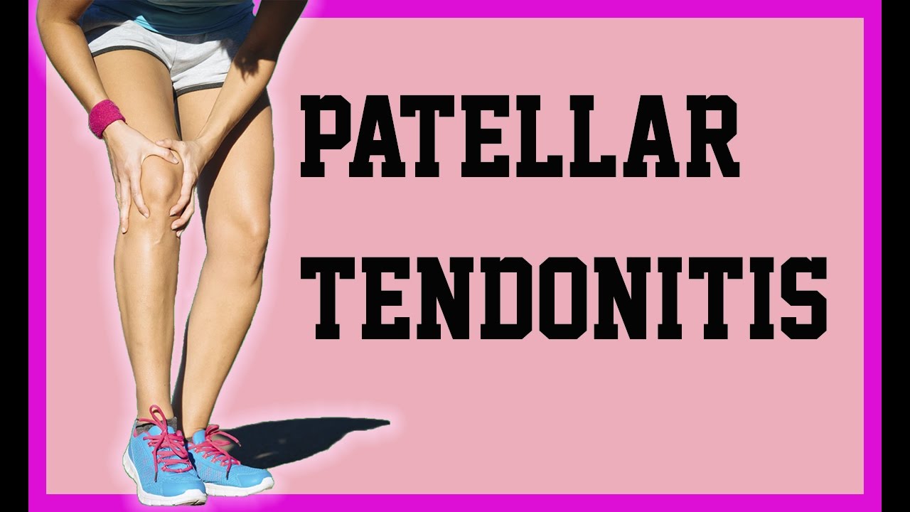 What Does Patellar Tendonitis Feel Like Patellar Tendonitis