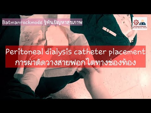 Peritoneal dialysis catheter placement การผ่าตัดวางสายฟอกไตทางช่องท้อง