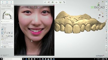 3DBioCAD - Digital Smile Design Pt.1 Quick 3D Smile Design
