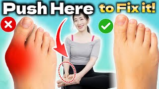 Instant Bunion Pain Relief Massage / How to Fix Bunions Naturally at Home