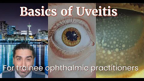 Basics of Uveitis | For Ophthalmic Practitioners in training