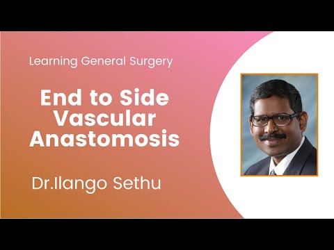 Video: Vim li cas vascular anastomoses tseem ceeb?