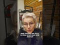 lifting twarzy bez skalpela