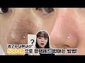 광고X) 5천원으로 블랙헤드 없애는 방법 🙆🏻‍♀️ 블랙헤드 고민인 사람 무조건❤️ +요즘 근황 잡담