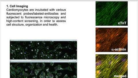 Generation of induced pluripotent stem cell-derived cardiomyocytes for disease modeling