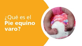¿Qué es el pie equino varo?