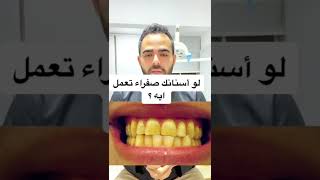 تعمل ايه لو لون أسنانك صفراء؟ أسباب اصفرار الأسنان وطرق علاجها!