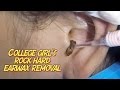 College Girl's Rock Hard Earwax Removal