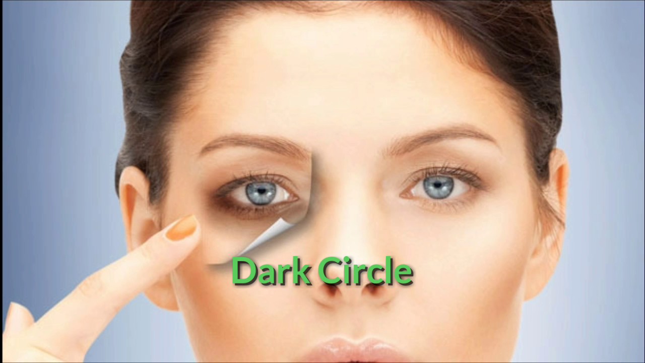 Remove dark circles with effective home remedies YouTube