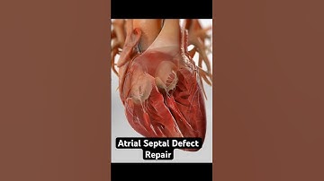 Repairing a hole in your heart (3D Animation)