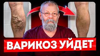 видео: КАК БЫСТРО ВЫЛЕЧИТЬ ВАРИКОЗ — ПОКАЗЫВАЮ 4 ТОЧКИ картинка: КАК БЫСТРО ВЫЛЕЧИТЬ ВАРИКОЗ — ПОКАЗЫВАЮ 4 ТОЧКИ