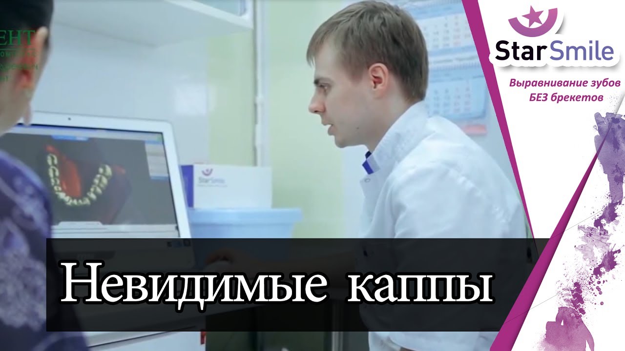 Мнение врача-ортодонта клиники ПрезиДент. Элайнеры для лечения прикуса